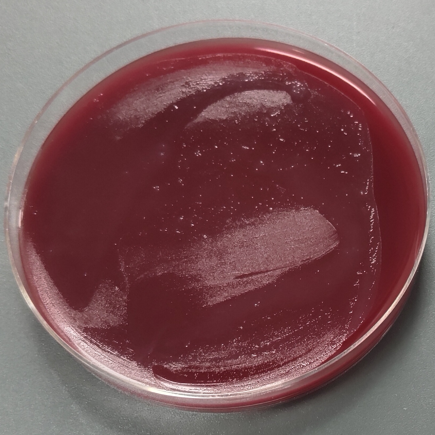Enterobacter faecalis-BNCC