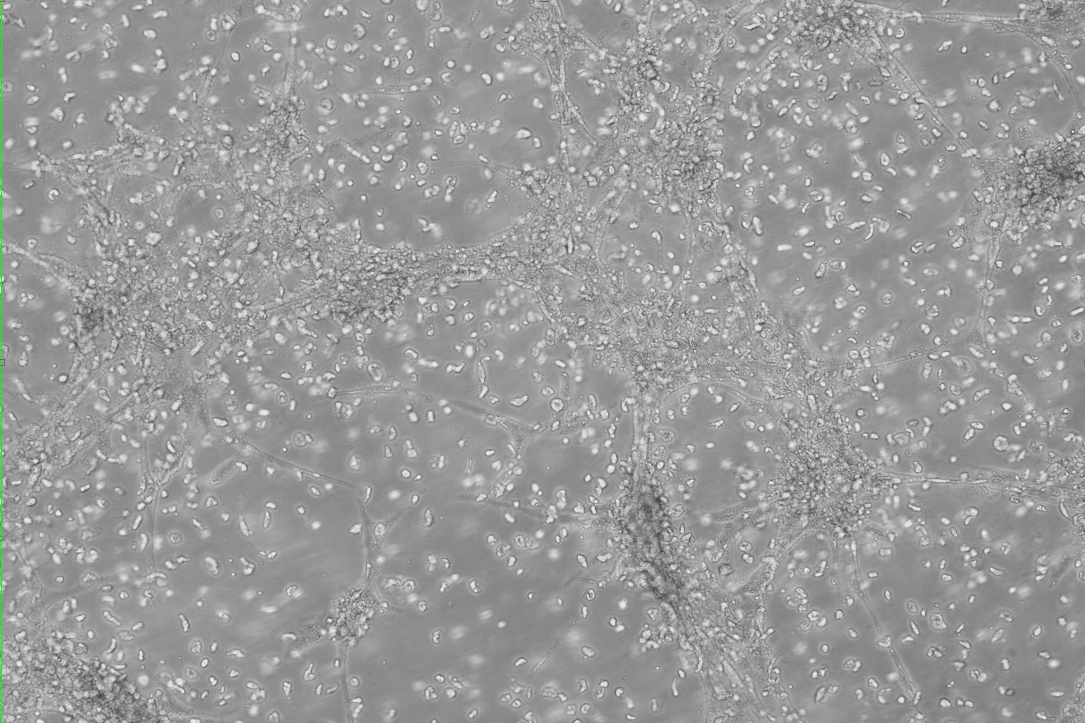 Novel coronavirus RNA nucleic acid quality control sample (high value)-BNCC