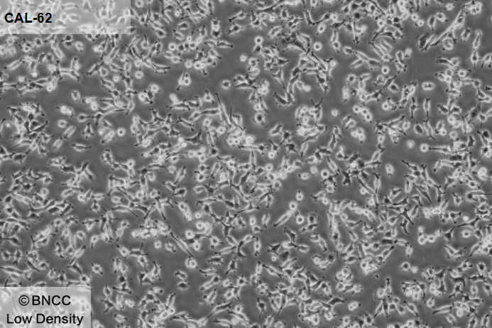 Human thyroid cancer cells (undifferentiated)-BNCC