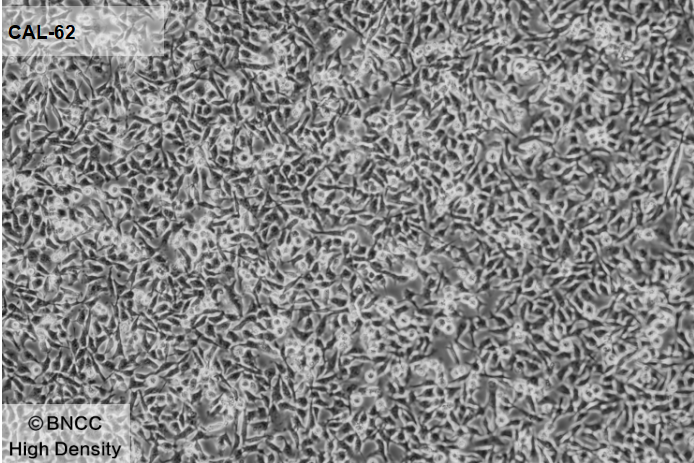 Human thyroid cancer cells (undifferentiated)-BNCC