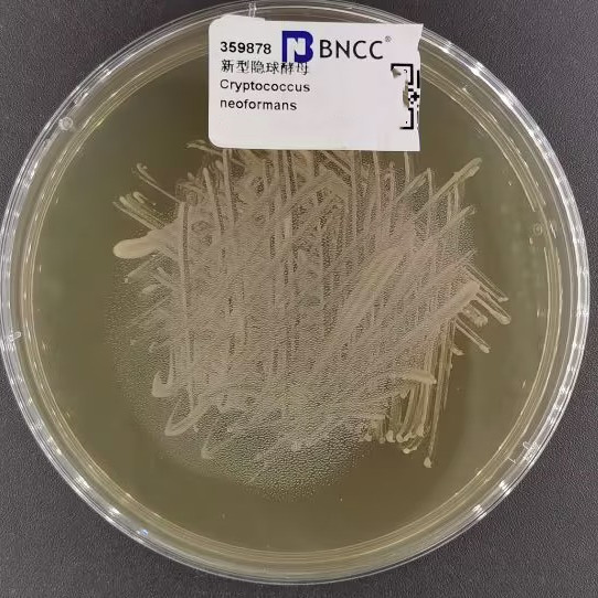 New type of cryptosphere yeast-BNCC