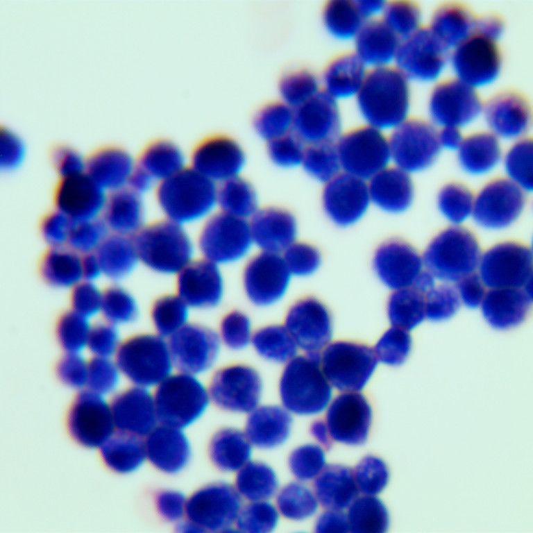 New type of cryptosphere yeast-BNCC