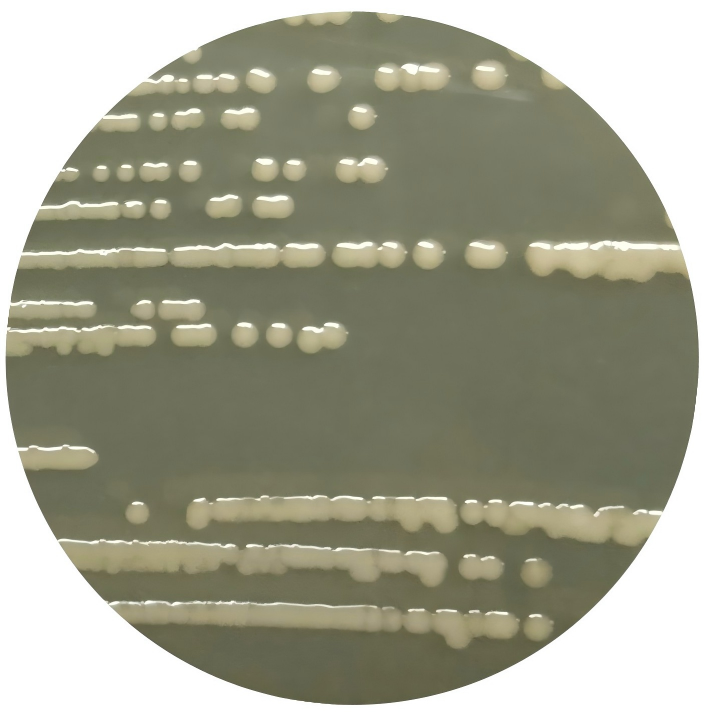 Acinetobacter portensis-BNCC