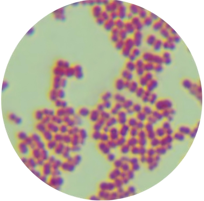 Acinetobacter portensis-BNCC