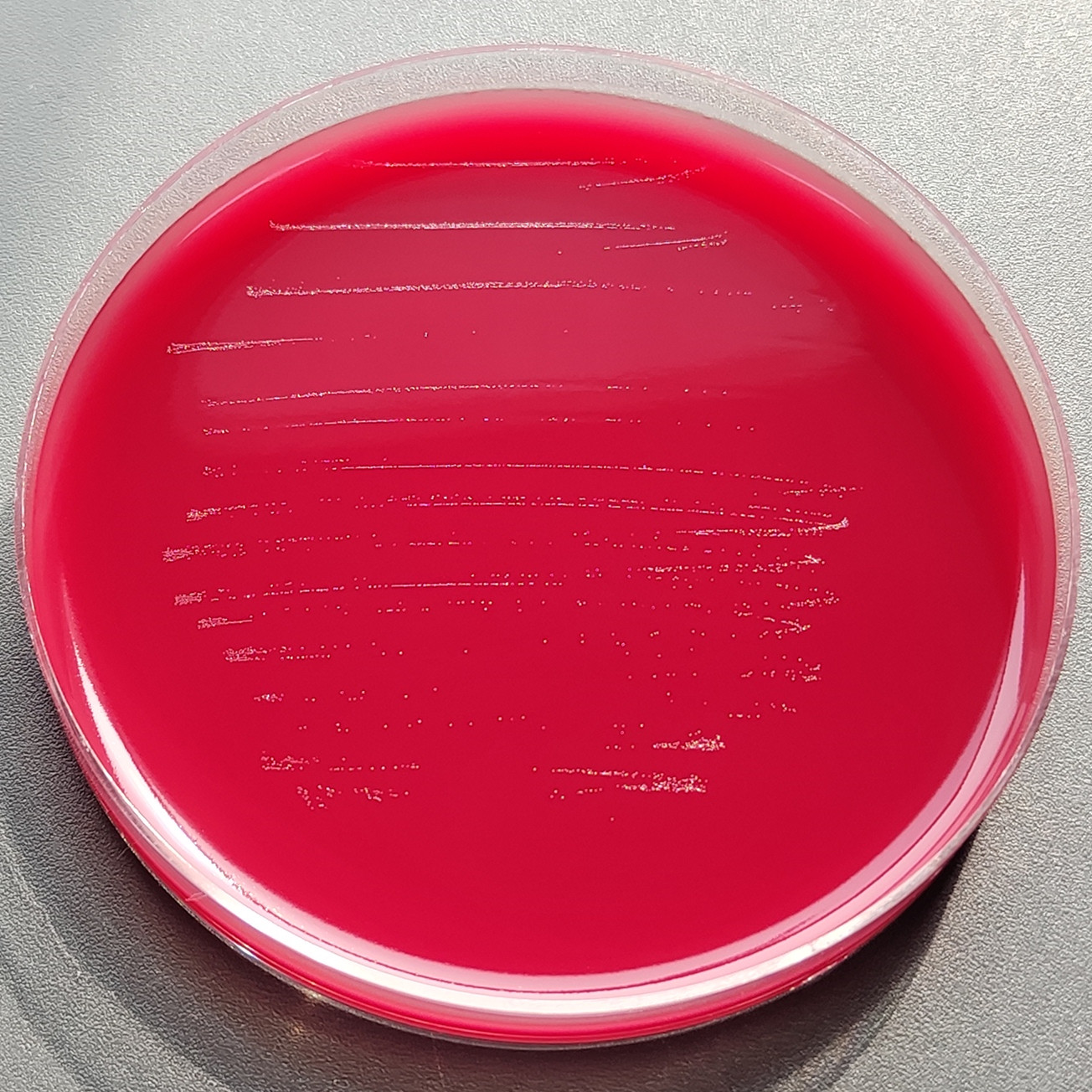 Rare variant cocci-BNCC