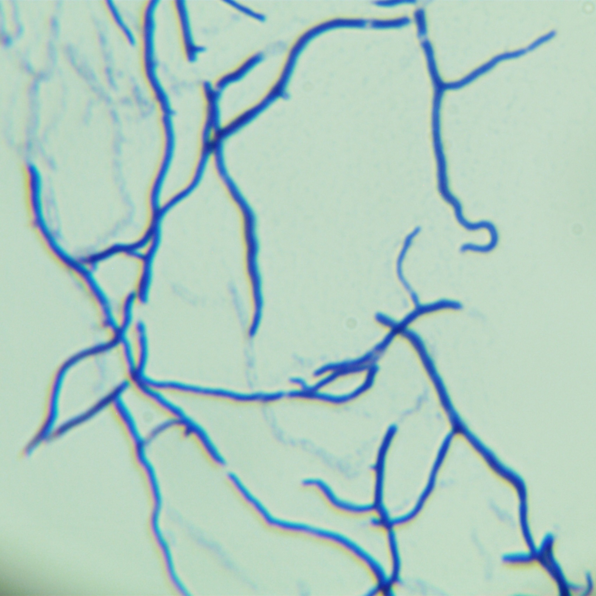 Streptomyces coelicolor-BNCC
