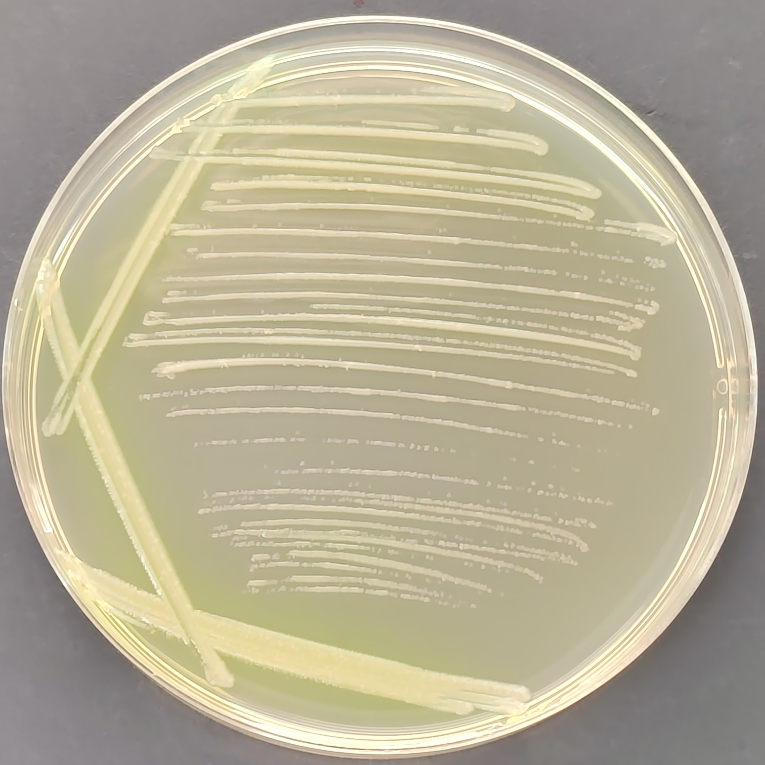 PAO1 Pseudomonas aeruginosa (green fluorescence)-BNCC