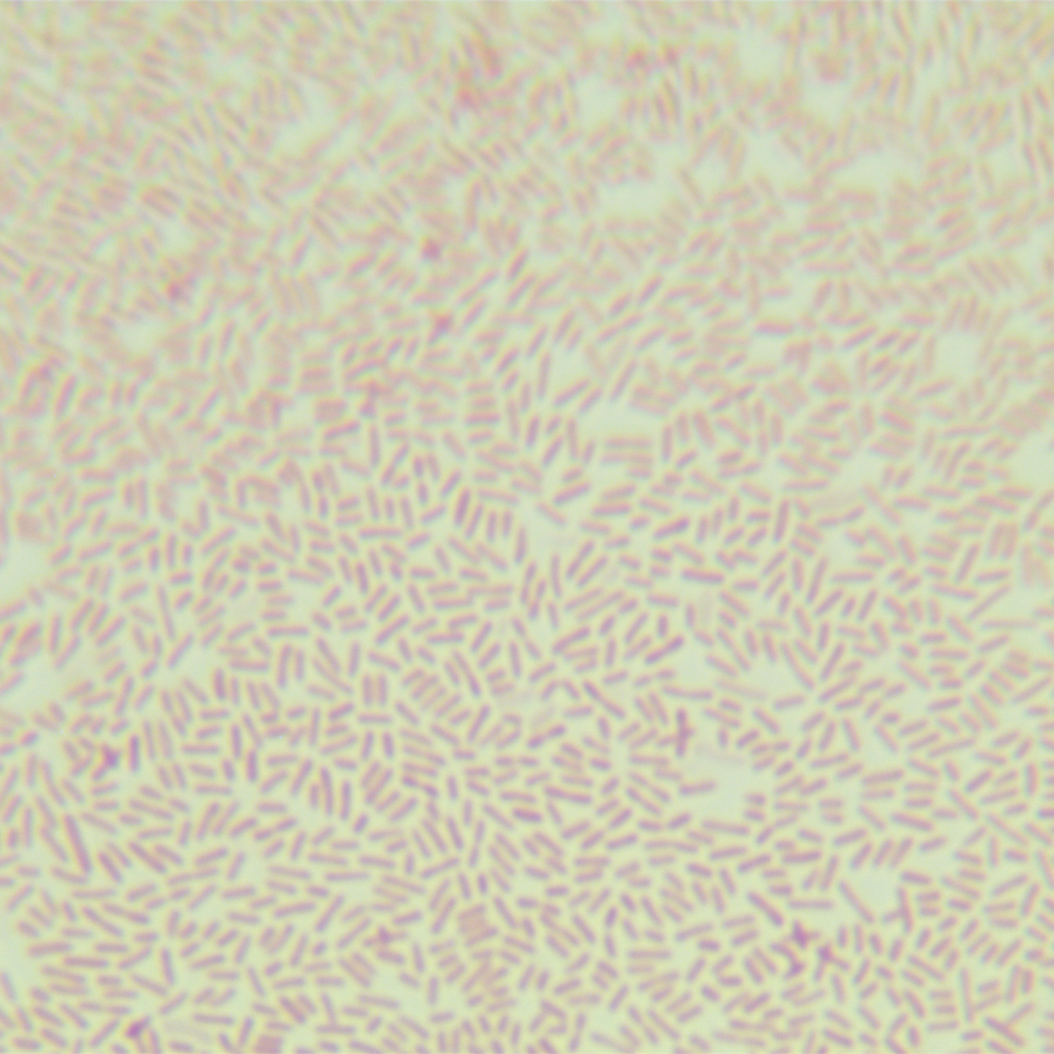 PAO1 Pseudomonas aeruginosa (green fluorescence)-BNCC