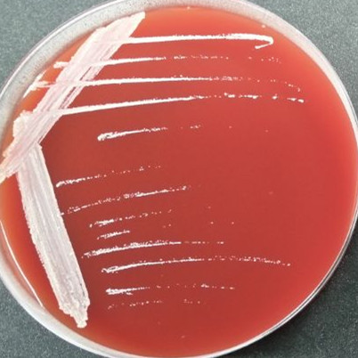 Corynebacterium flexneri-BNCC
