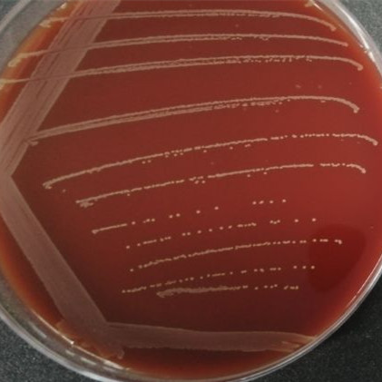 Yellow lipophilic bacillus-BNCC