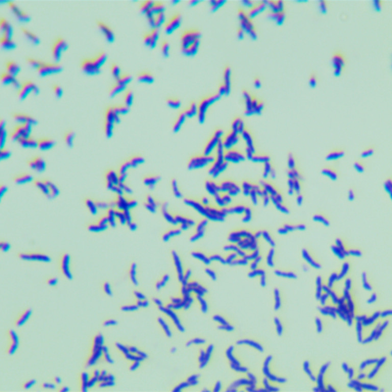 Yellow lipophilic bacillus-BNCC