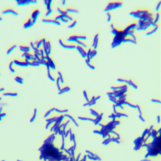 Gordon's bacteria in sewage-BNCC