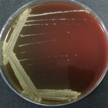 Gordon's bacteria in sewage-BNCC