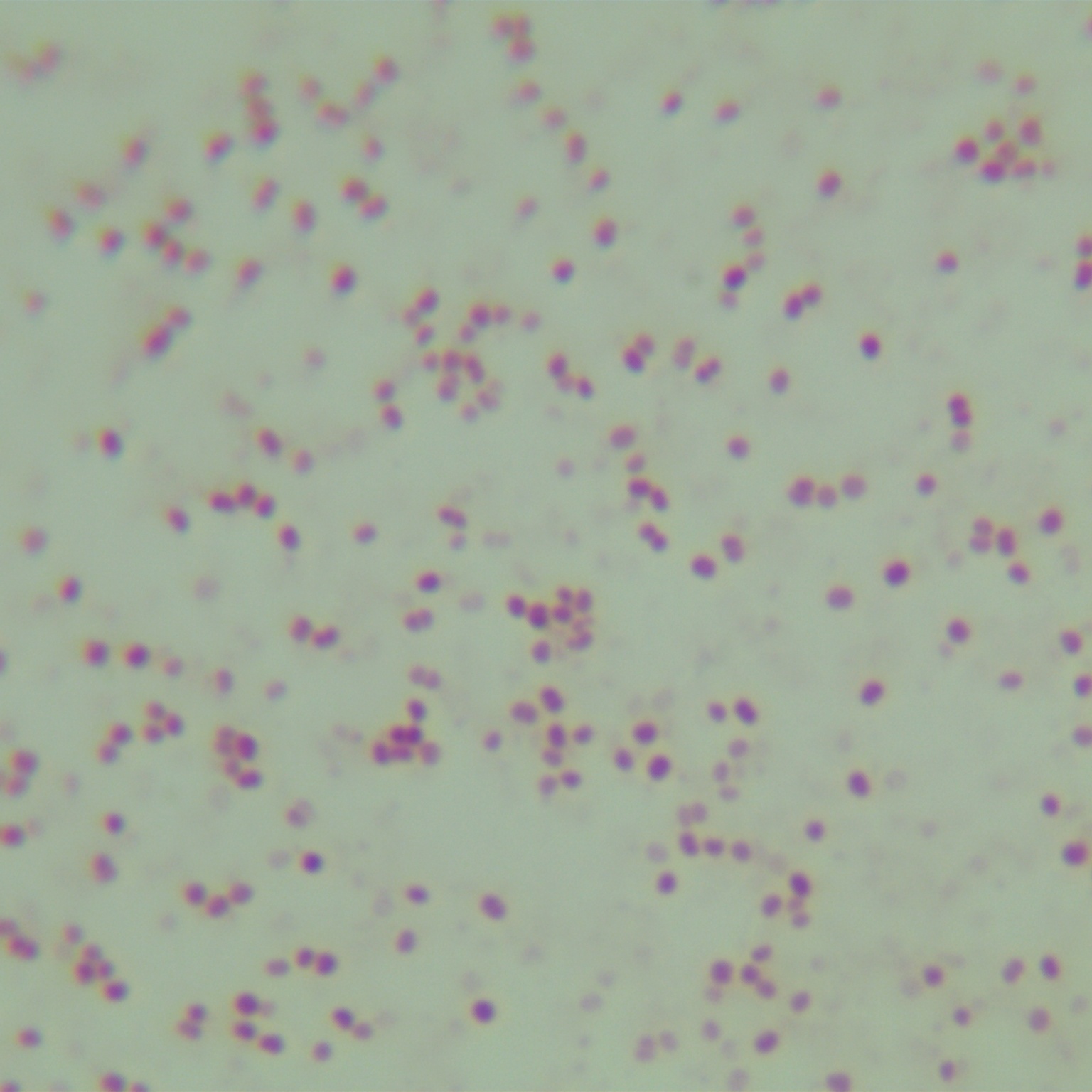 Neisseria gonorrhoeae-BNCC
