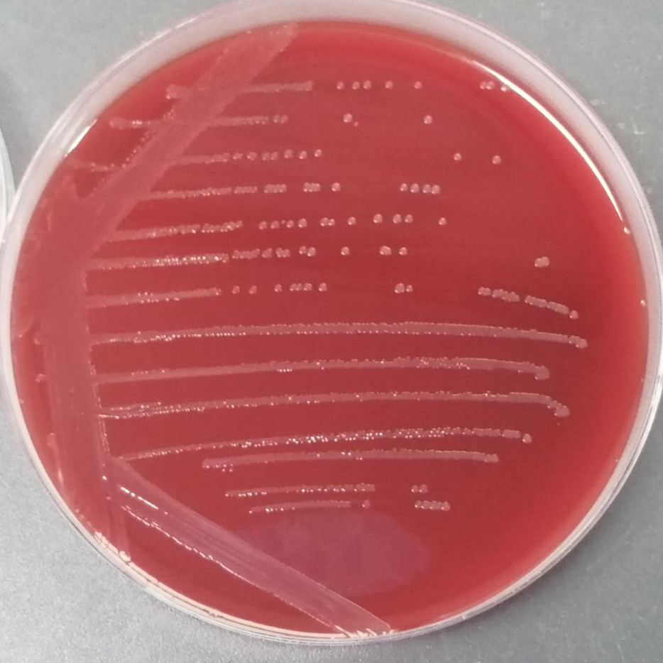 Neisseria gonorrhoeae-BNCC