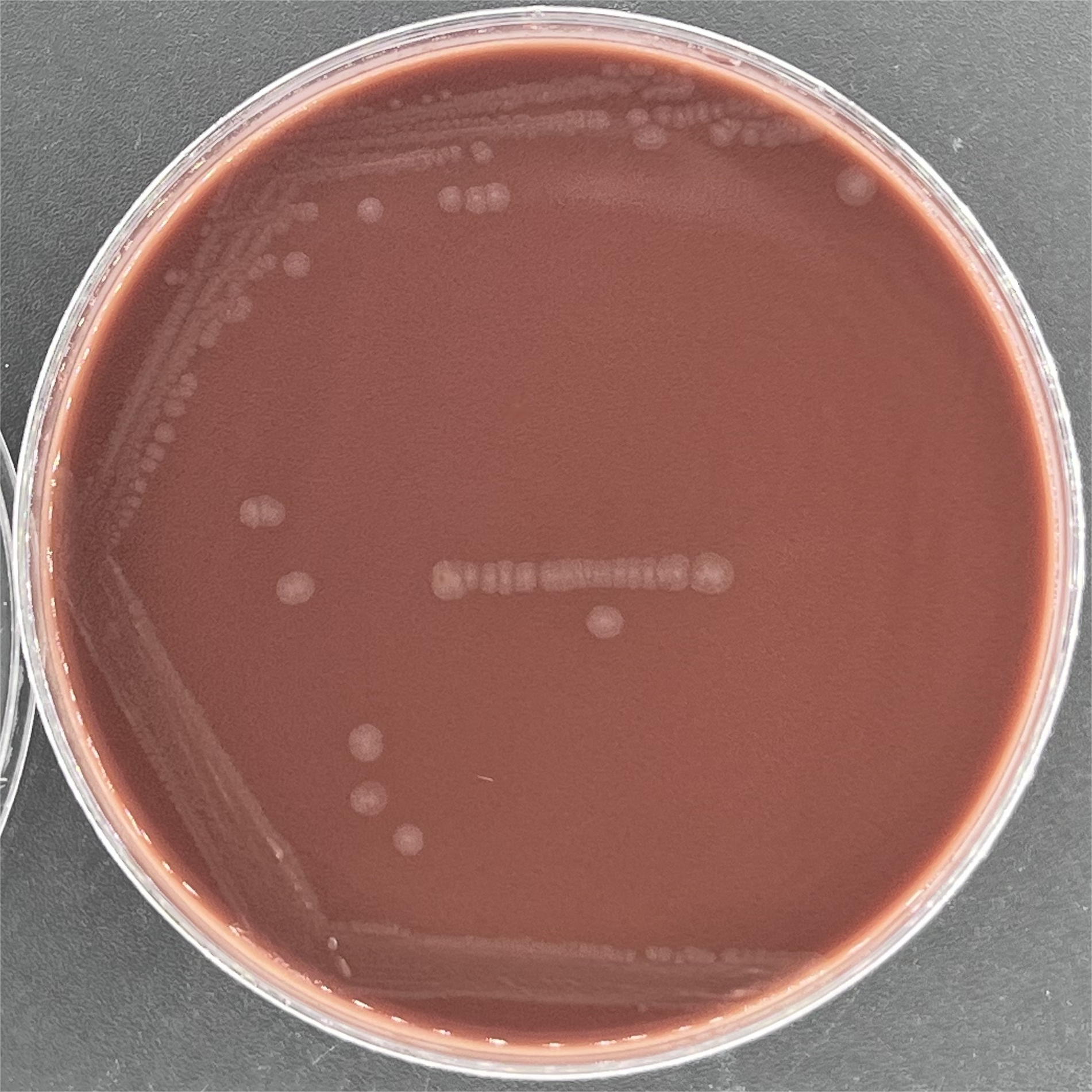 Neisseria gonorrhoeae-BNCC