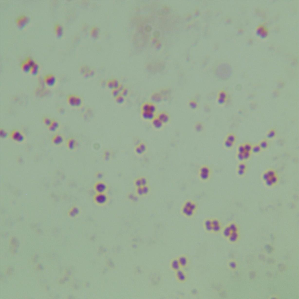Neisseria gonorrhoeae-BNCC