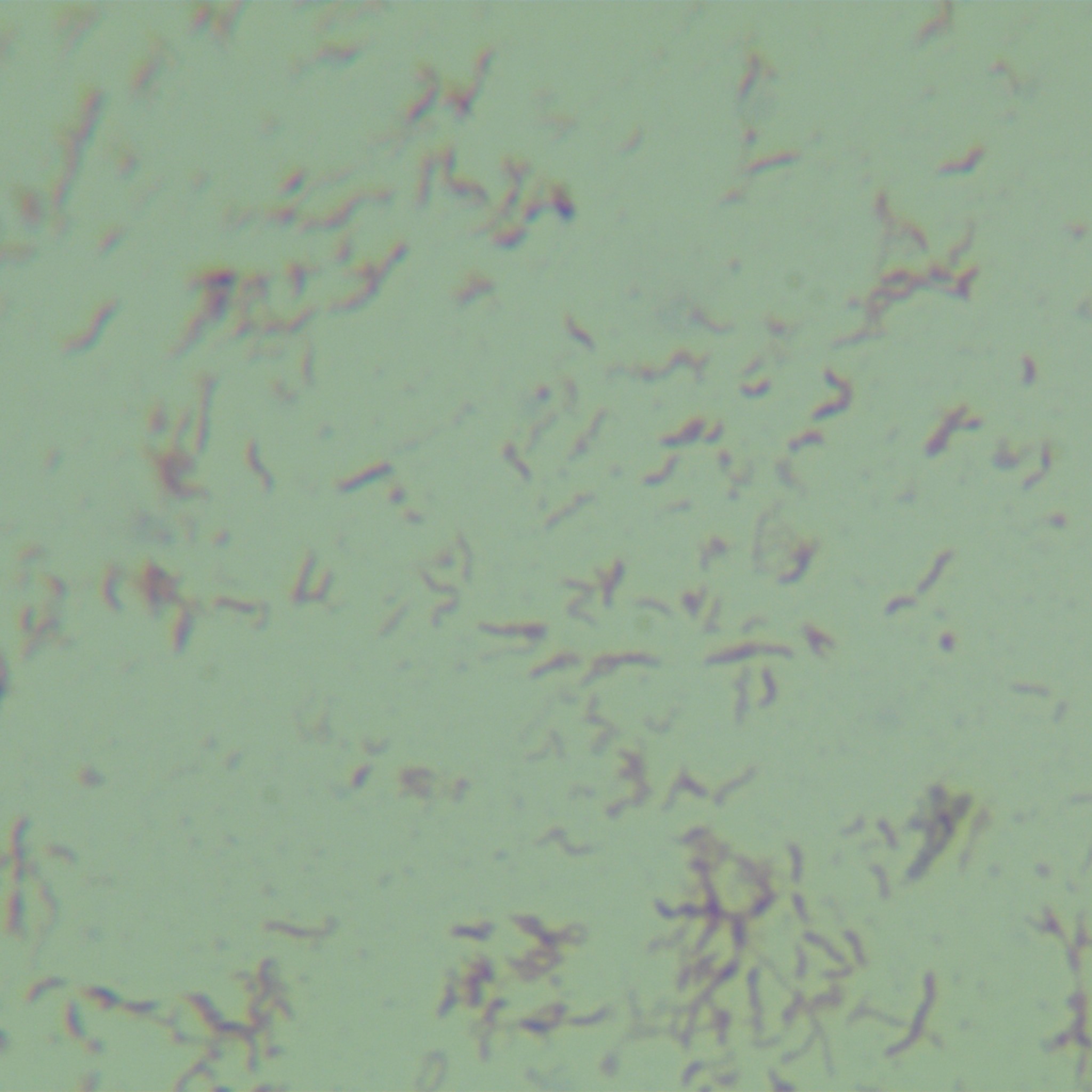 Fetal Campylobacter subspecies of sexually transmitted diseases-BNCC