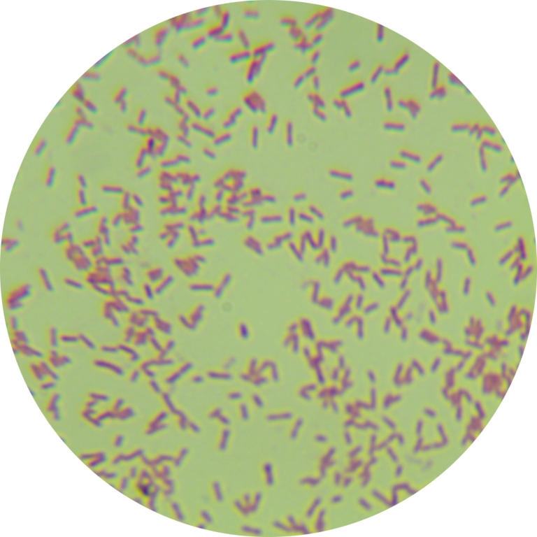 PAO1 Pseudomonas aeruginosa Luc tagged plasmid type-BNCC