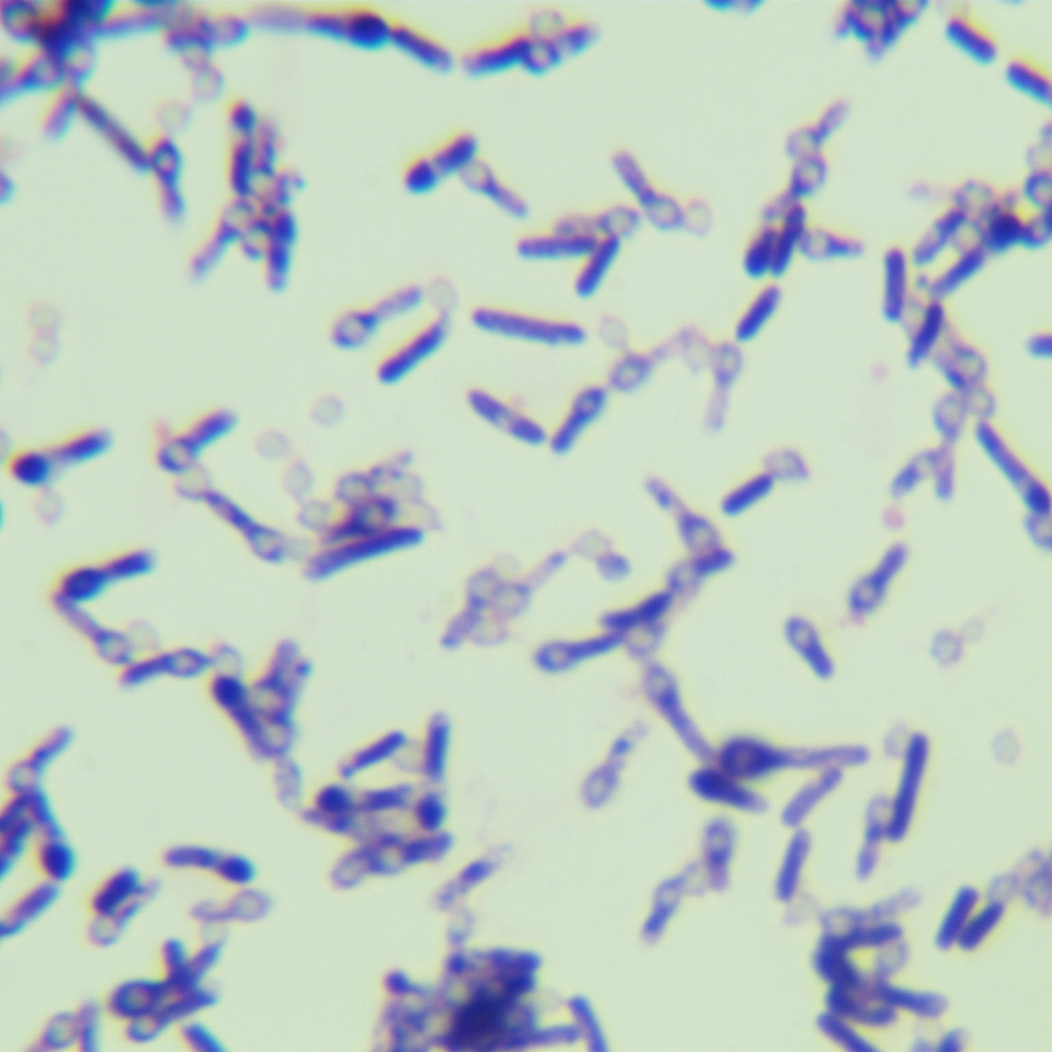 Fake Tetanus Clostridium-BNCC