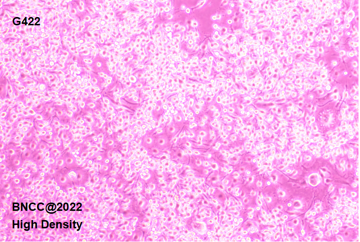 KM mouse glioblastoma cell line-BNCC