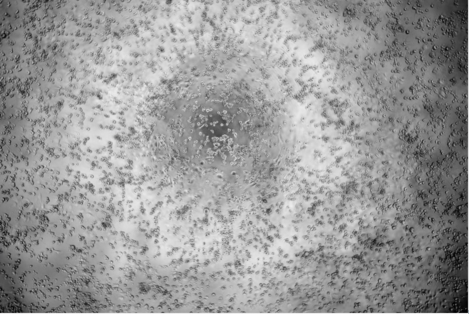 Human Coxsackievirus B2-BNCC