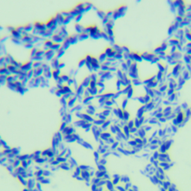 Geotrichum-BNCC
