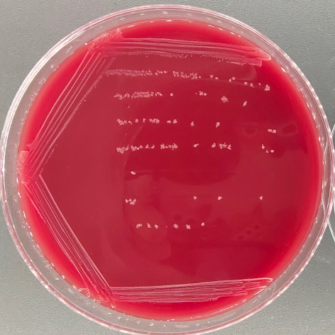 Fusarium oxysporum-BNCC