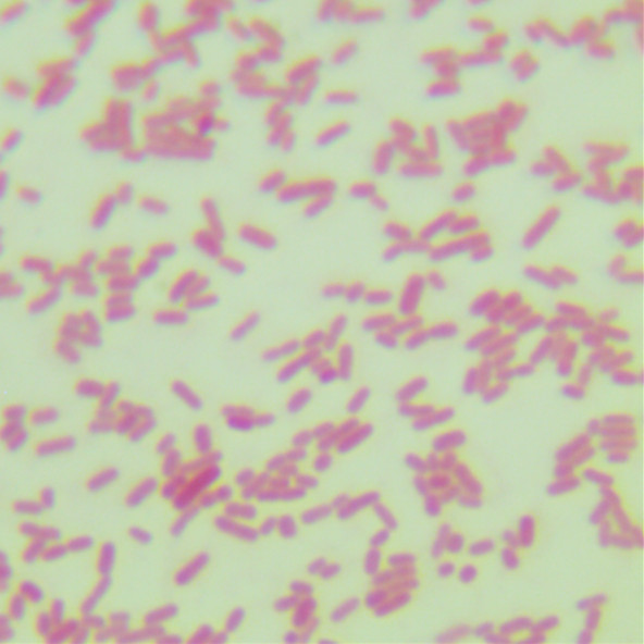 Escherichia coli-BNCC