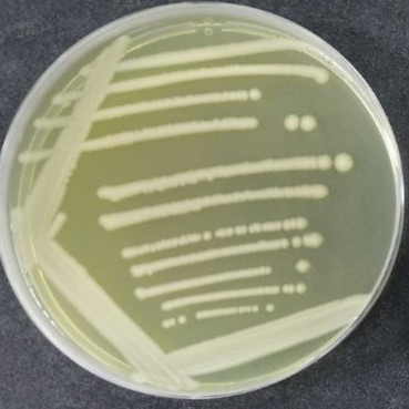Escherichia coli-BNCC