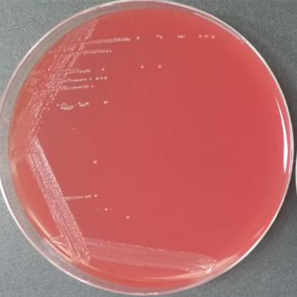 Neisseria gonorrhoeae-BNCC