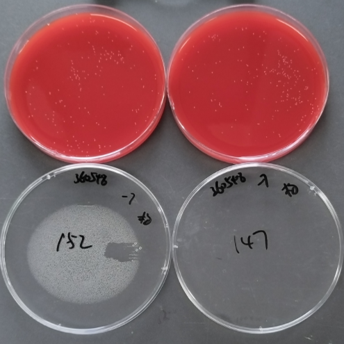 Neisseria gonorrhoeae-BNCC