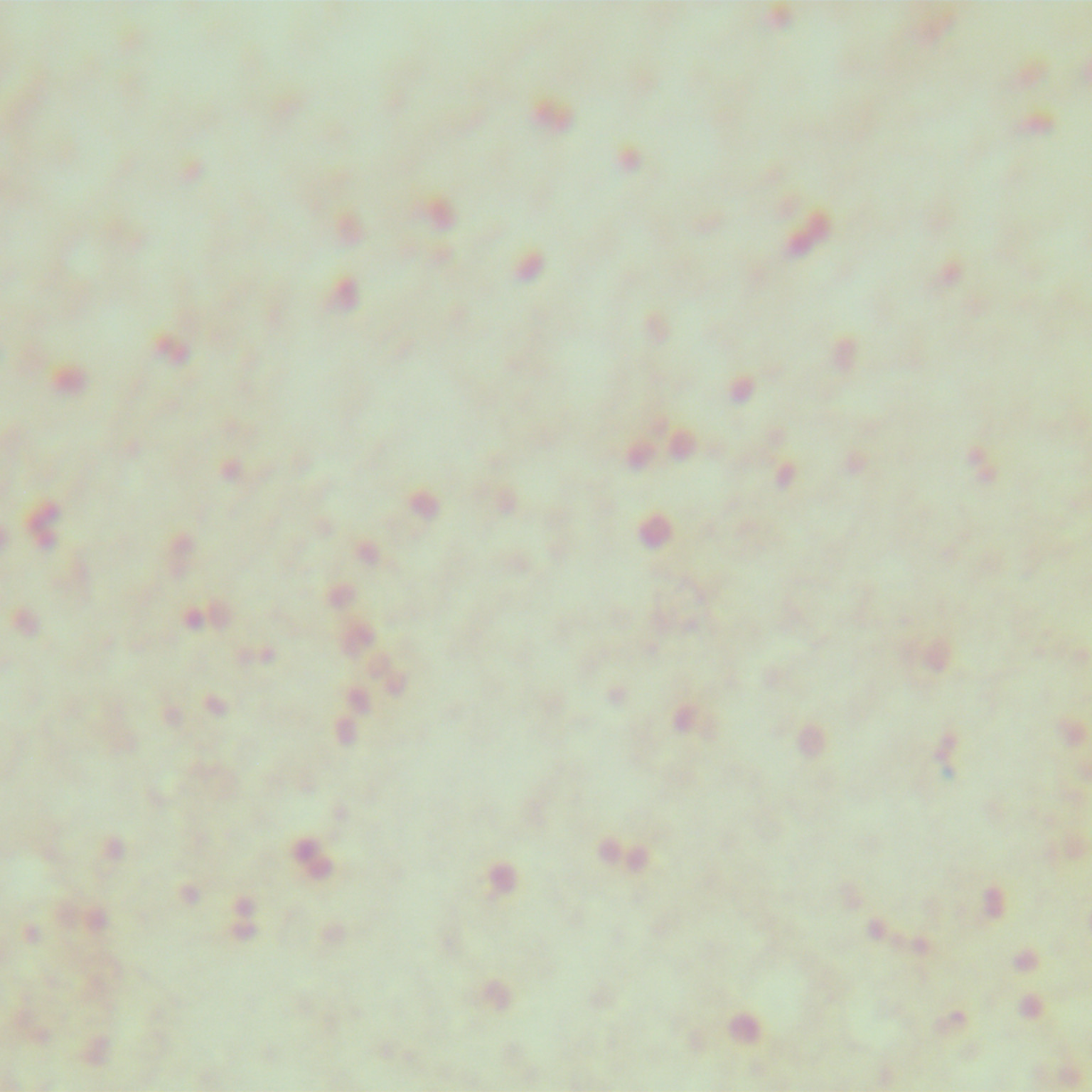 Neisseria gonorrhoeae-BNCC