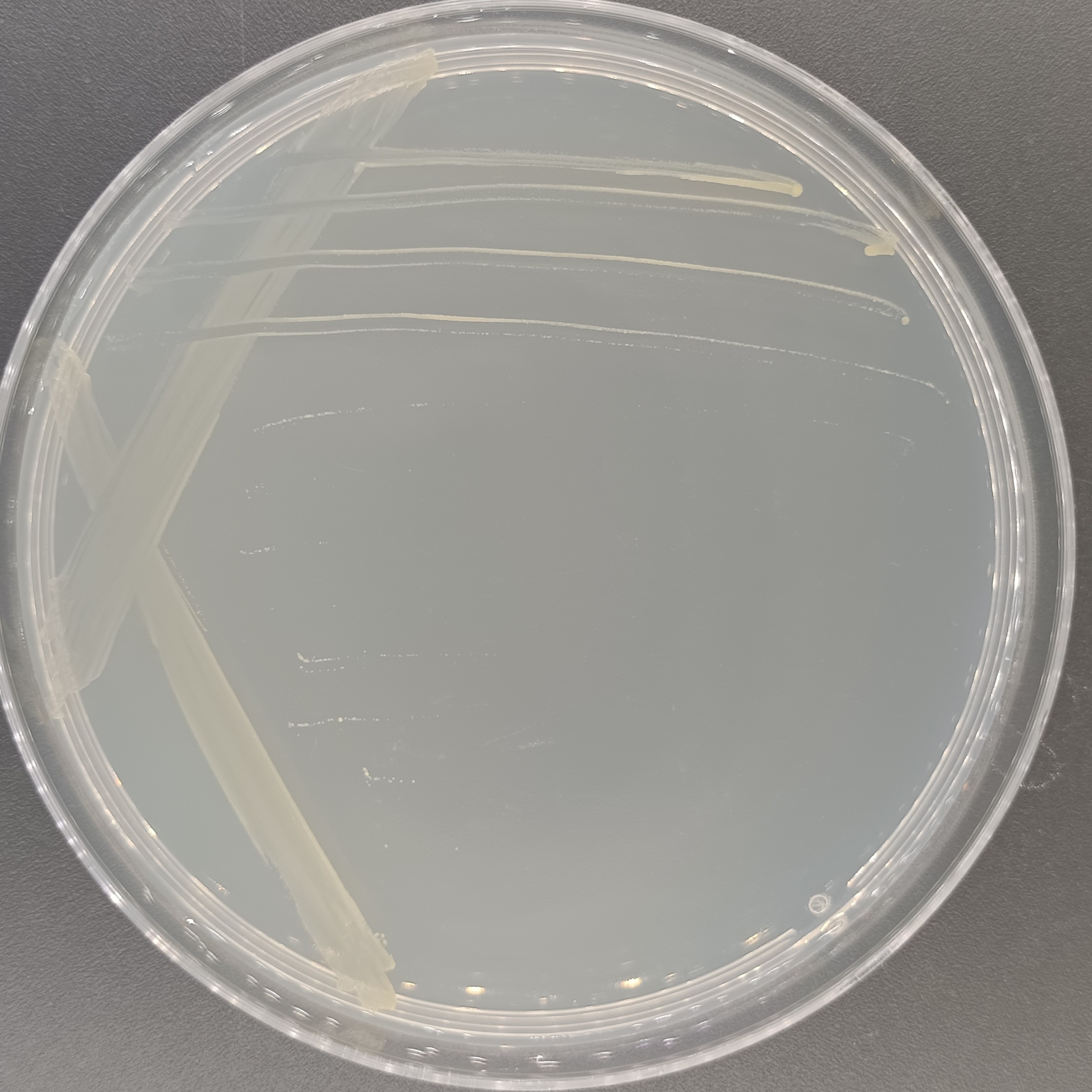 Madagascar Mycobacterium-BNCC
