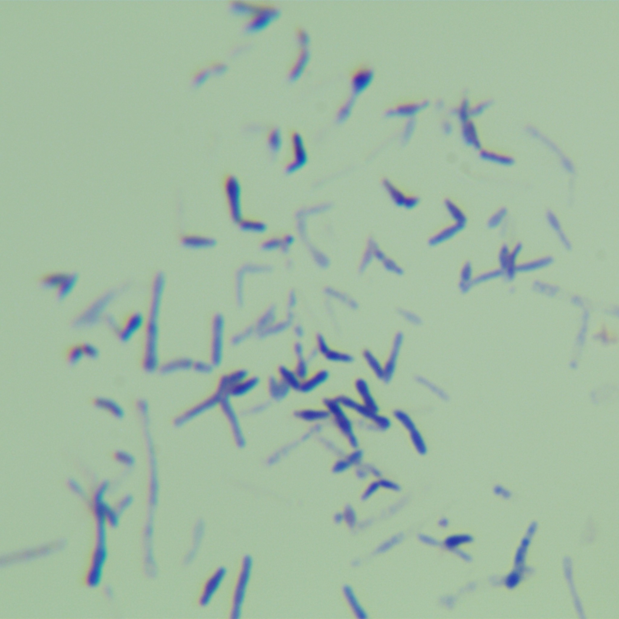 Madagascar Mycobacterium-BNCC