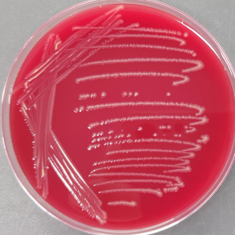 Variable Clostridium-BNCC