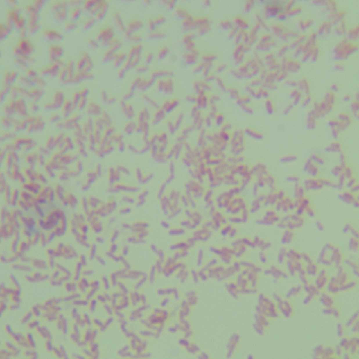 Variable Clostridium-BNCC