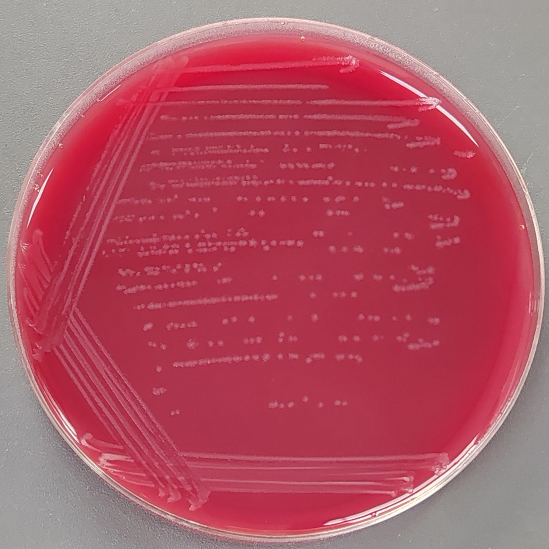 Clostridium difficile-BNCC