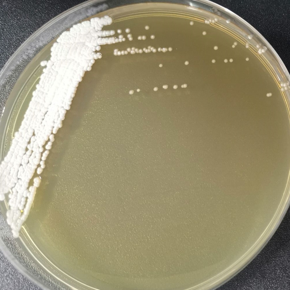 Fine yellow chain fungi-BNCC