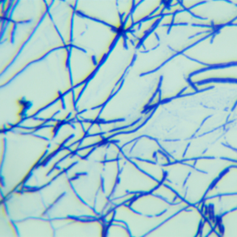 Fine yellow chain fungi-BNCC