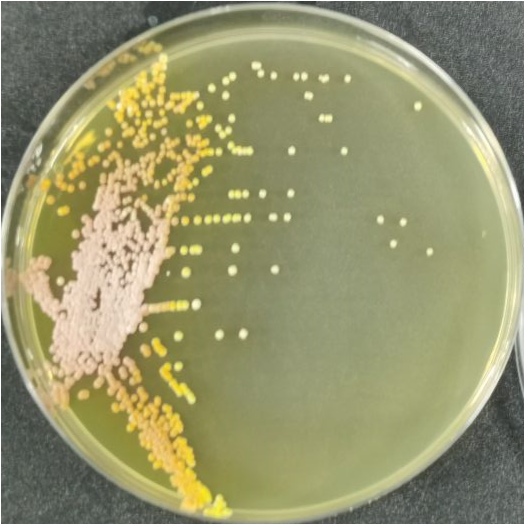 Fine yellow chain fungi-BNCC
