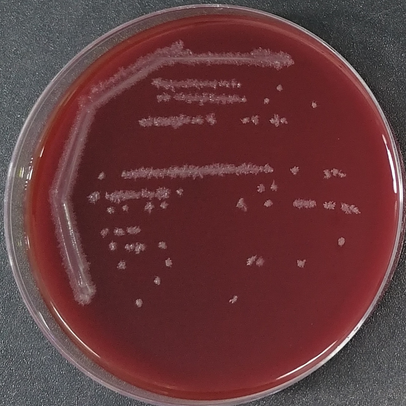 Clostridium sporogenes-BNCC
