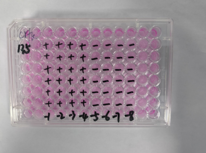 Pseudorabies virus-BNCC