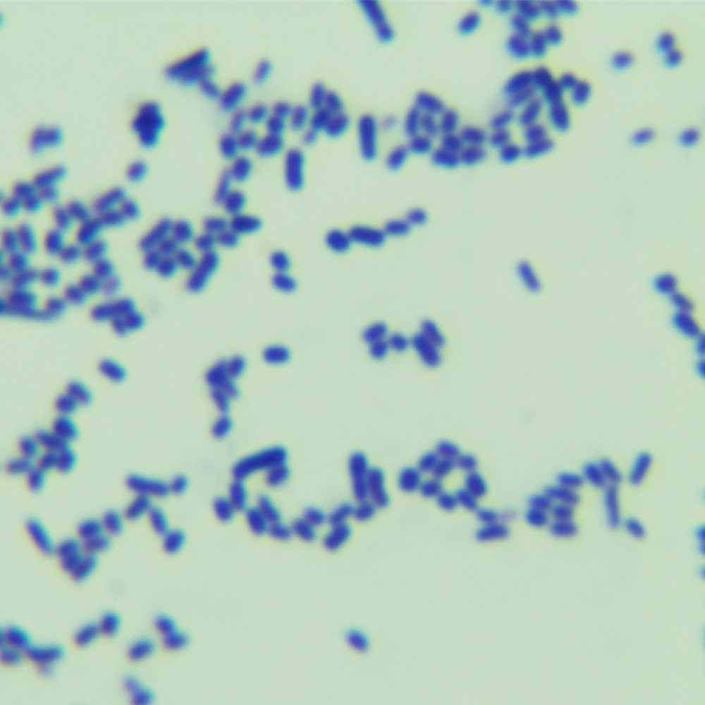 Olive Streptomyces-BNCC
