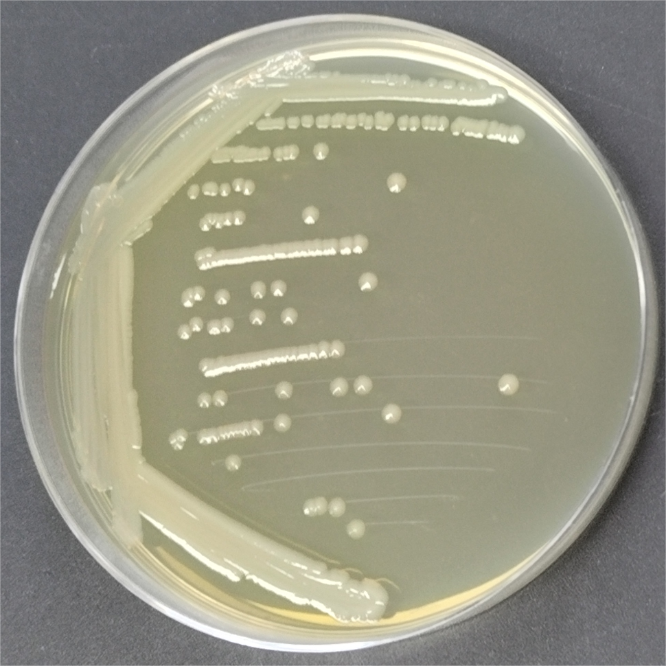 Salmonella enterica subsp. enterica-BNCC
