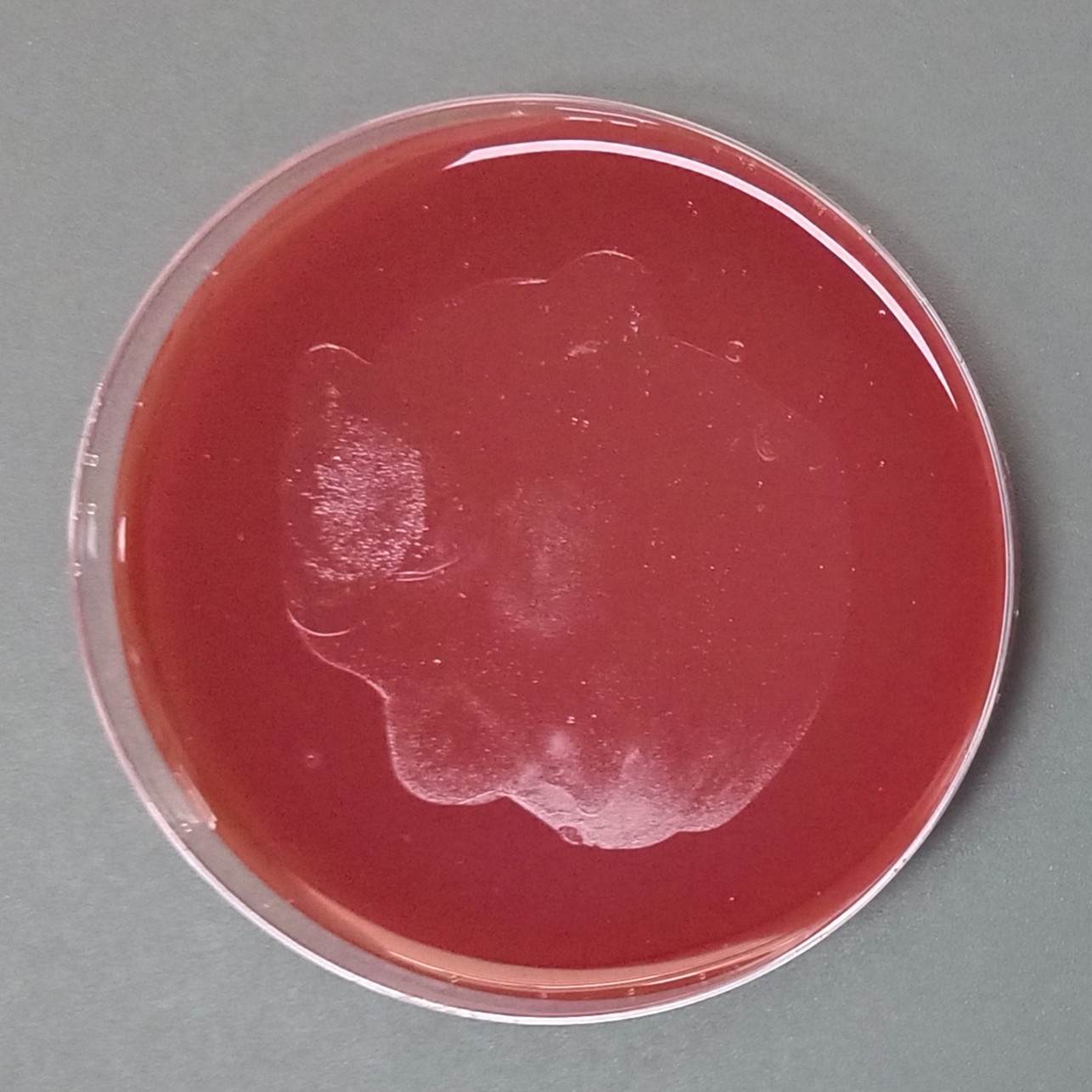 Helicobacter pylori-BNCC
