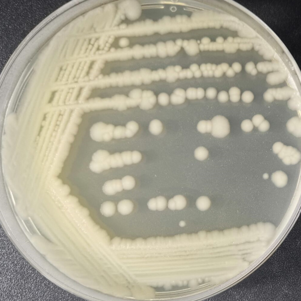 Bacillus subtilis-BNCC