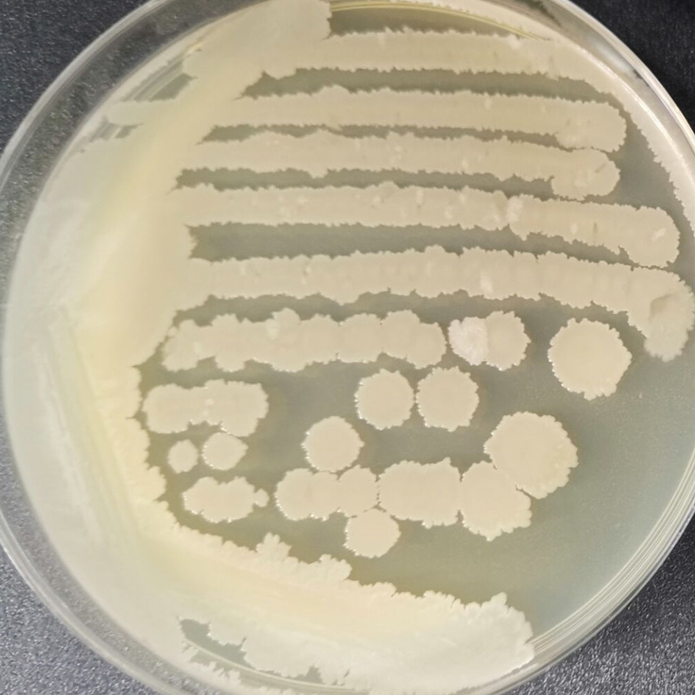 Bacillus subtilis-BNCC
