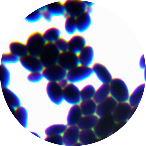 Abnormal Wickham yeast-BNCC