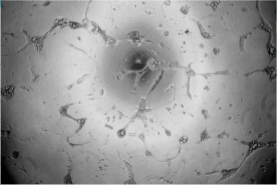 Human Herpesvirus 1-BNCC